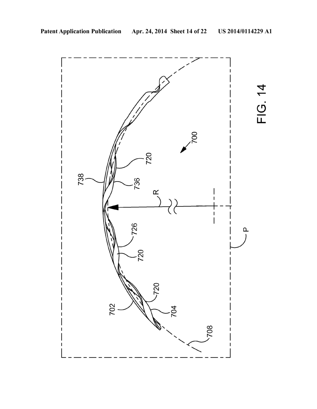 OCULAR IMPLANTS FOR DELIVERY INTO THE EYE - diagram, schematic, and image 15