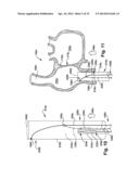 APPARATUS AND METHOD FOR TARGETING A BODY TISSUE diagram and image