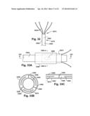 APPARATUS AND METHOD FOR TARGETING A BODY TISSUE diagram and image