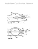 APPARATUS AND METHOD FOR TARGETING A BODY TISSUE diagram and image