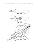 APPARATUS AND METHOD FOR TARGETING A BODY TISSUE diagram and image