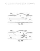 APPARATUS AND METHOD FOR TARGETING A BODY TISSUE diagram and image