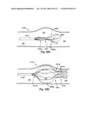 APPARATUS AND METHOD FOR TARGETING A BODY TISSUE diagram and image