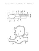 APPARATUS AND METHOD FOR TARGETING A BODY TISSUE diagram and image