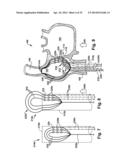 APPARATUS AND METHOD FOR TARGETING A BODY TISSUE diagram and image