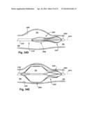 APPARATUS AND METHOD FOR TARGETING A BODY TISSUE diagram and image