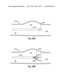 APPARATUS AND METHOD FOR TARGETING A BODY TISSUE diagram and image