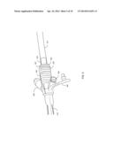 FEEDING TUBE EXTENSION diagram and image