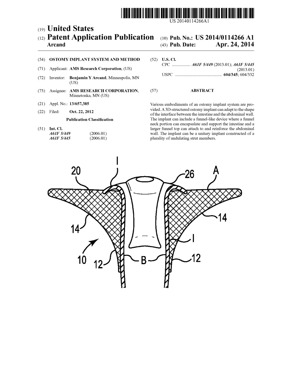 Ostomy Implant System and Method - diagram, schematic, and image 01