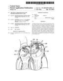 ABLATION CATHETER SYSTEM AND METHOD FOR DEPLOYING SAME diagram and image