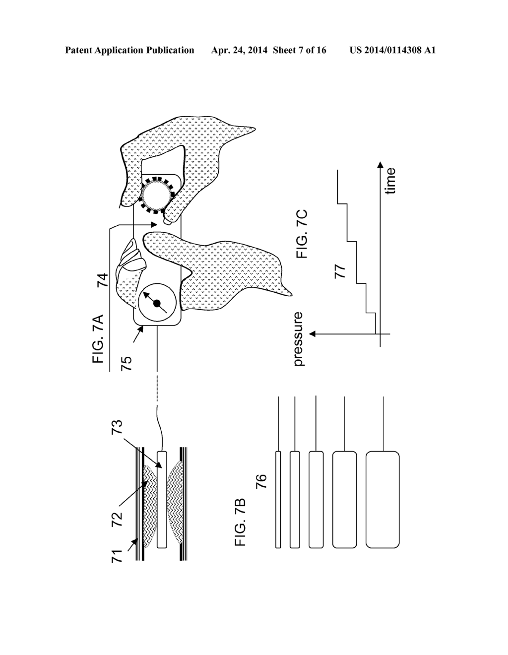 STABILIZED ENERGY-DELIVERY PROCEDURES - diagram, schematic, and image 08