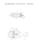 INTRAMEDULLARY IMPLANTS FOR REPLACING LOST BONE diagram and image