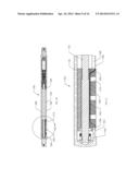 INTRAMEDULLARY IMPLANTS FOR REPLACING LOST BONE diagram and image