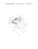 INTRAMEDULLARY IMPLANTS FOR REPLACING LOST BONE diagram and image