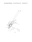 INTRAMEDULLARY IMPLANTS FOR REPLACING LOST BONE diagram and image