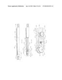 INTRAMEDULLARY IMPLANTS FOR REPLACING LOST BONE diagram and image