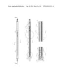 INTRAMEDULLARY IMPLANTS FOR REPLACING LOST BONE diagram and image