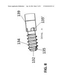 Flexible Intramedullary Nail diagram and image