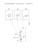 TREATMENT OF AN OCCLUSION OF A BLOOD VESSEL diagram and image