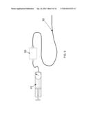 TREATMENT OF AN OCCLUSION OF A BLOOD VESSEL diagram and image