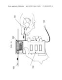 TREATMENT OF AN OCCLUSION OF A BLOOD VESSEL diagram and image