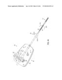 FLEXIBLE HARMONIC WAVEGUIDES/BLADES FOR SURGICAL INSTRUMENTS diagram and image