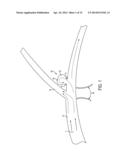 FLEXIBLE VASCULAR OCCLUDING DEVICE diagram and image