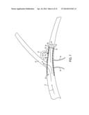 FLEXIBLE VASCULAR OCCLUDING DEVICE diagram and image