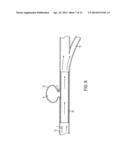 FLEXIBLE VASCULAR OCCLUDING DEVICE diagram and image