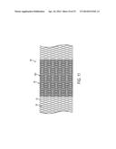 FLEXIBLE VASCULAR OCCLUDING DEVICE diagram and image