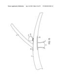 FLEXIBLE VASCULAR OCCLUDING DEVICE diagram and image