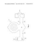 Electrode Configuration for Implantable Modulator diagram and image