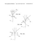 Electrode Configuration for Implantable Modulator diagram and image