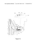 Electrode Configuration for Implantable Modulator diagram and image