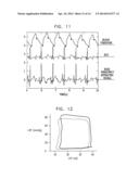 VAGUS NERVE STIMULATION diagram and image