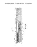 MR-COMPATIBLE IMPLANTABLE MEDICAL LEAD diagram and image