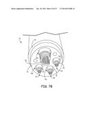 MR-COMPATIBLE IMPLANTABLE MEDICAL LEAD diagram and image