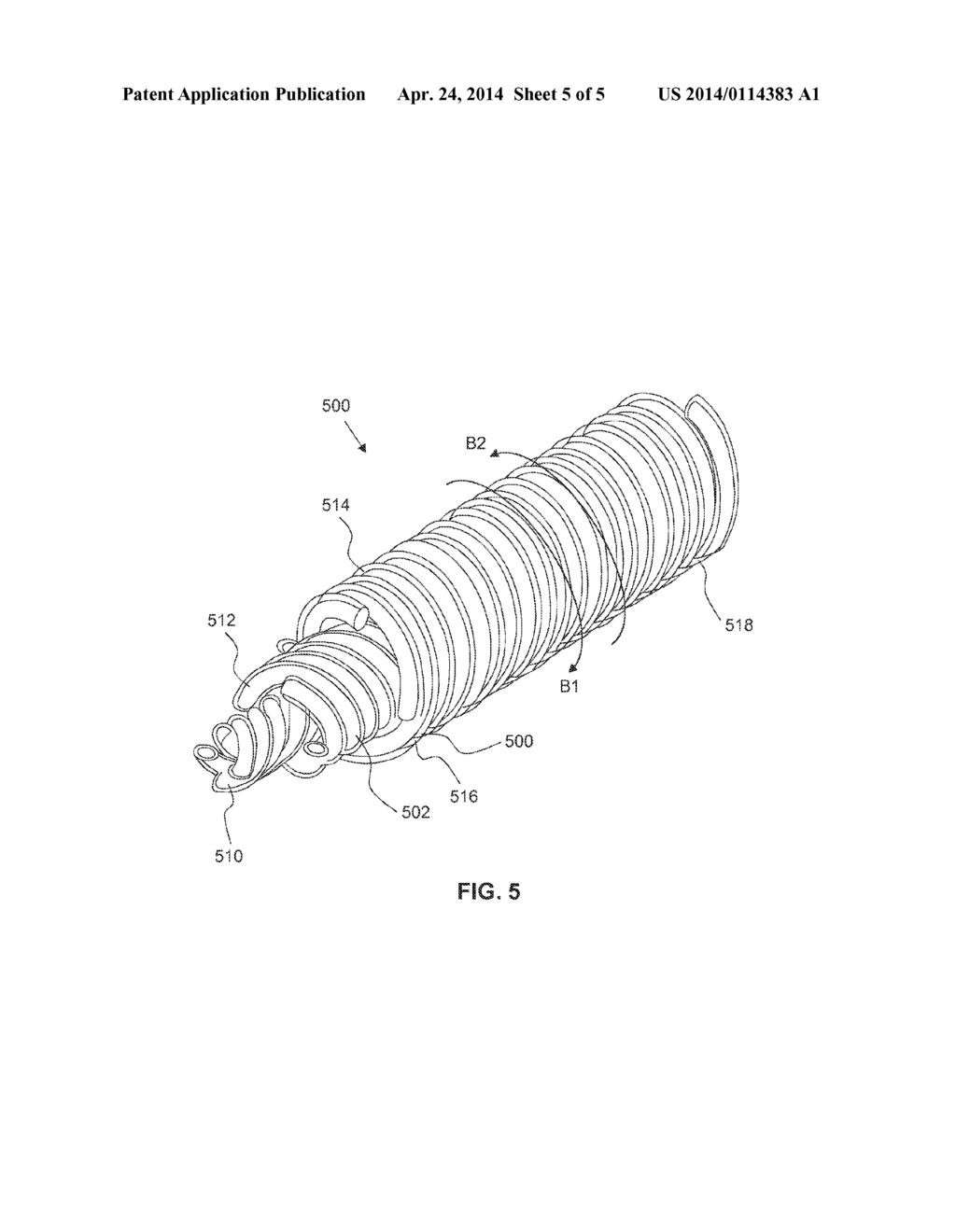 INDUCTIVE ELEMENT FOR PROVIDING MRI COMPATIBILITY IN AN IMPLANTABLE     MEDICAL DEVICE LEAD - diagram, schematic, and image 06