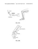 METHODS FOR VASCULAR RESTORATION THERAPY diagram and image