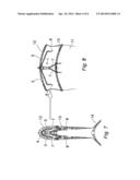 DEVICE FOR SECURING A PROSTHESIS TO THE INTERNAL WALL OF A BODY LUMEN diagram and image