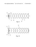 DEVICE FOR SECURING A PROSTHESIS TO THE INTERNAL WALL OF A BODY LUMEN diagram and image