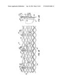 LOW PROFILE HEART VALVE AND DELIVERY SYSTEM diagram and image