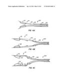 LOW PROFILE HEART VALVE AND DELIVERY SYSTEM diagram and image