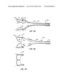 LOW PROFILE HEART VALVE AND DELIVERY SYSTEM diagram and image