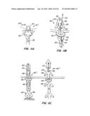 LOW PROFILE HEART VALVE AND DELIVERY SYSTEM diagram and image