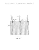 LOW PROFILE HEART VALVE AND DELIVERY SYSTEM diagram and image