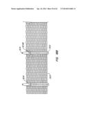 LOW PROFILE HEART VALVE AND DELIVERY SYSTEM diagram and image