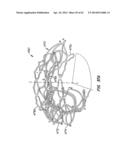 LOW PROFILE HEART VALVE AND DELIVERY SYSTEM diagram and image