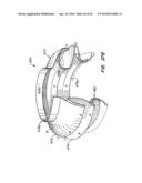 LOW PROFILE HEART VALVE AND DELIVERY SYSTEM diagram and image