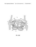 LOW PROFILE HEART VALVE AND DELIVERY SYSTEM diagram and image